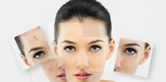 Stock photography - Image