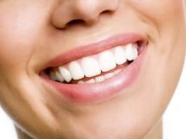 white teeth