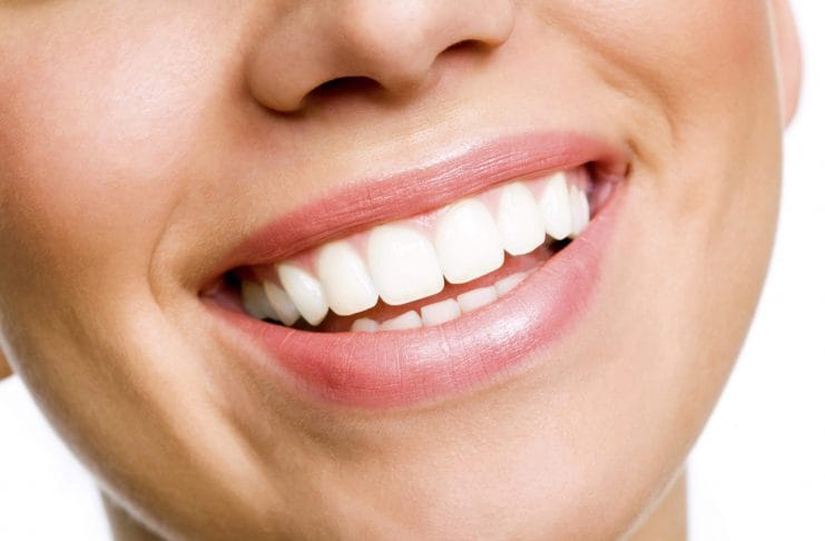 white teeth