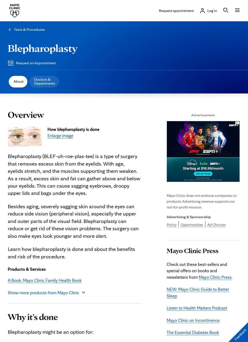 Mayo Clinic - Blepharoplasty